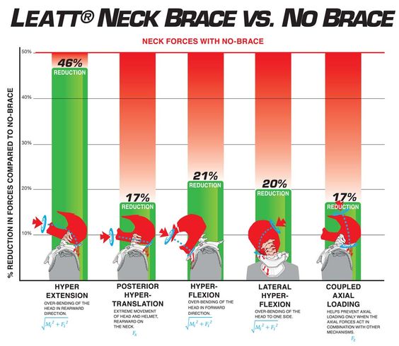 Neck Brace vs No Neck Brace